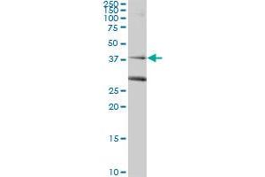 RAD51C monoclonal antibody (M01), clone 3F3-5C6.
