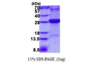 Figure annotation denotes ug of protein loaded and % gel used. (Adipsin Protéine)