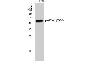 Western Blotting (WB) image for anti-Mitogen-Activated Protein Kinase Kinase 1 (MAP2K1) (pThr386) antibody (ABIN5959683) (MEK1 anticorps  (pThr386))
