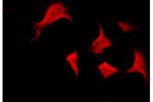 ABIN6266574 staining HepG2 by IF/ICC.