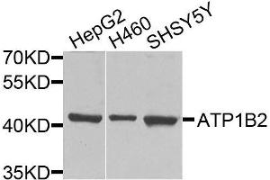 Western blot analysis of extracts of various cell lines, using ATP1B2 antibody.