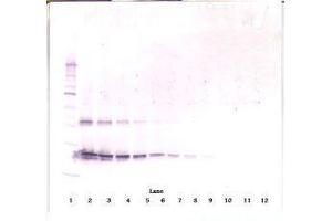 Image no. 1 for anti-Ciliary Neurotrophic Factor (CNTF) antibody (ABIN465749) (CNTF anticorps)