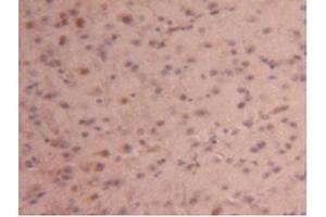 IHC-P analysis of Mouse Brain Tissue, with DAB staining. (CPB2 anticorps  (AA 187-327))