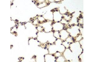 Immunohistochemistry of paraffin-embedded Mouse lung using GSS Polyclonal Antibody at dilution of 1:200 (40x lens). (Glutathione Synthetase anticorps)