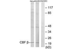 Western blot analysis of extracts from HuvEc/HeLa cells, using CBF beta Antibody. (CBFB anticorps  (AA 11-60))