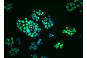 Immunoflourescent staining of PDX-1 in mouse pancreatic tumor (insulinoma) cells. (PDX1 anticorps)