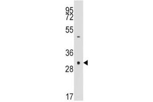 Western blot analysis of anti-Caspase-3 antibody and NCI-H460 lysate.