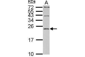 WB Image IL1 Receptor antagonist antibody detects IL1RN protein by Western blot analysis.