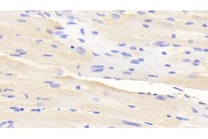 Detection of ADAMTS2 in Mouse Cardiac Muscle Tissue using Polyclonal Antibody to A Disintegrin And Metalloproteinase With Thrombospondin 2 (ADAMTS2)