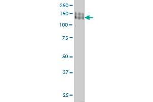 PCDH1 monoclonal antibody (M01), clone 5D5 Western Blot analysis of PCDH1 expression in A-431 .