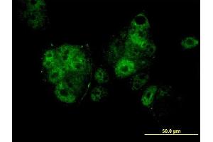 Immunofluorescence of monoclonal antibody to MEF2A on MCF-7 cell. (MEF2A anticorps  (AA 71-170))