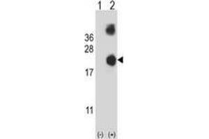 Western blot analysis of DSTN (arrow) using Destrin Antibody .