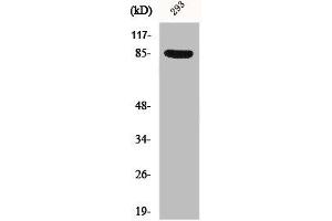Western Blot analysis of 293 cells using Phospho-Cortactin (Y466) Polyclonal Antibody (Cortactin anticorps  (pTyr466))