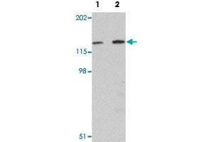 Western blot analysis of mouse skeletal muscle tissue with MYBPC2 polyclonal antibody  at (Lane 1) 1 and (Lane 2) 2 ug/mL dilution.
