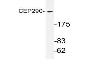 Western blot (WB) analysis of CEP290 antibody in extracts from K562 cells. (CEP290 anticorps)