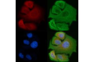 ABIN6257299 and ABIN6275373 staining Hela cells by IF/ICC. (KCNK17 anticorps)