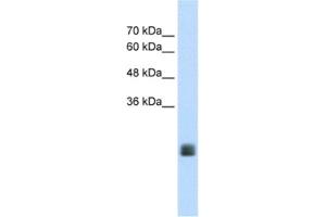 Western Blotting (WB) image for anti-Transmembrane Protein 178A (TMEM178A) antibody (ABIN2462646) (TMEM178 anticorps)