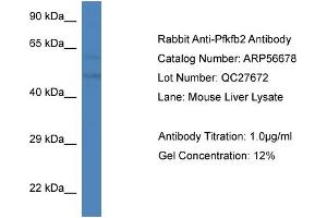 Western Blotting (WB) image for anti-6-phosphofructo-2-Kinase/fructose-2,6-Biphosphatase 2 (PFKFB2) (C-Term) antibody (ABIN2786834) (PFKFB2 anticorps  (C-Term))