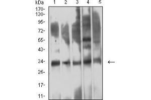 Western blot analysis using CD354 mouse mAb against HepG2 (1), COS7 (2), A549 (3), SPC-A-1 (4), and C6 (5) cell lysate.