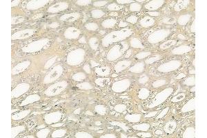 ABIN6261219 and ABIN6277510 at 1/100 staining human normal kidney tissue by IHC-P.