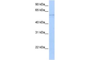 Western Blotting (WB) image for anti-Kynureninase (L-Kynurenine Hydrolase) (KYNU) antibody (ABIN2462923) (KYNU anticorps)