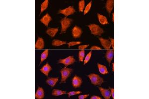 Immunofluorescence analysis of L929 cells using SEC11A Rabbit pAb (ABIN6133117, ABIN6147478, ABIN6147479 and ABIN6214843) at dilution of 1:100.