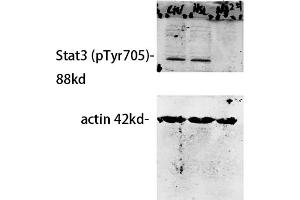Western Blot analysis of our customer's samples using primary antibody diluted at 1:500, The picture was kindly provided by our customer.