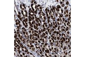Immunohistochemical staining of human stomach with RSAD1 polyclonal antibody  shows strong cytoplasmic positivity in Parietal cells. (RSAD1 anticorps)
