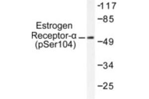 Image no. 2 for anti-Estrogen Receptor 1 (ESR1) (pSer104) antibody (ABIN318016) (Estrogen Receptor alpha anticorps  (pSer104))