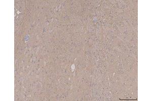 IHC analysis of Tau/MAPT using anti-Tau/MAPT antibody (ABIN7599268). (MAPT anticorps  (AA 1-322))
