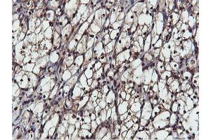 Image no. 3 for anti-V-Akt Murine Thymoma Viral Oncogene Homolog 1 (AKT1) antibody (ABIN1496555)