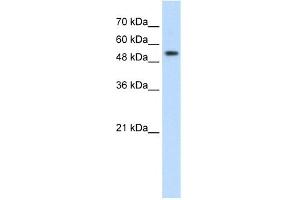 WB Suggested Anti-PRPF19 Antibody Titration:  2. (PRP19 anticorps  (Middle Region))