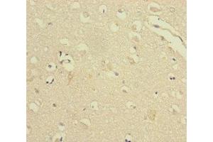Immunohistochemistry of paraffin-embedded human brain tissue using ABIN7175312 at dilution of 1:100 (VPS33B anticorps  (AA 348-617))