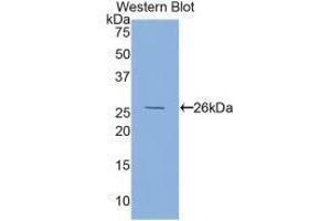 Western blot analysis of the recombinant protein. (FOLR1 anticorps  (AA 26-229))