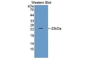 Western Blotting (WB) image for anti-Growth Arrest and DNA-Damage-Inducible, alpha (GADD45A) (AA 1-165) antibody (ABIN1868086) (GADD45A anticorps  (AA 1-165))