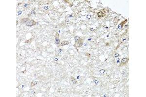 Immunohistochemistry of paraffin-embedded Rat brain using METTL13 Polyclonal Antibody at dilution of 1:100 (40x lens). (METTL13 anticorps)