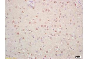 Formalin-fixed and paraffin embedded rat brain labeled with Rabbit Anti Phospho-p57 Kip2 (Thr310) Polyclonal Antibody, Unconjugated (ABIN703045) at 1:200 followed by conjugation to the secondary antibody and DAB staining (CDKN1C anticorps  (pThr310))