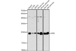 Western blot analysis of extracts of various cell lines, using SSR2 antibody (ABIN7270299) at 1:1000 dilution. (SSR2 anticorps)