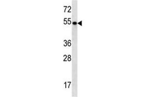 TBC1D3E antibody western blot analysis in NCI-H292 lysate (TBC1D3E (AA 498-527) anticorps)