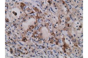 Immunohistochemical staining of paraffin-embedded Human liver tissue using anti-SDR9C7 mouse monoclonal antibody.
