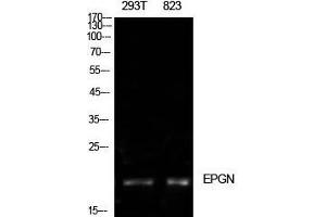 Western Blot (WB) analysis of 293T, 823 cells using Epigen Polyclonal Antibody. (Epigen anticorps  (Internal Region))