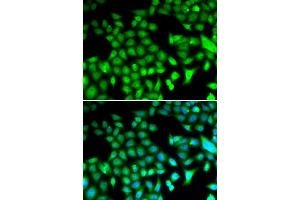 Immunofluorescence analysis of HeLa cells using FOSL1 antibody (ABIN5973108). (FOSL1 anticorps)