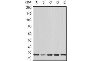 Western blot analysis of COX2 expression in Hela (A), MCF7 (B), Jurkat (C), mouse brain (D), rat brain (E) whole cell lysates. (COX2 anticorps)