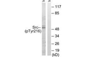 Western blot analysis of extracts from Jurkat cells treated with EGF 200ng/ml 5', using Src (Phospho-Tyr216) Antibody. (Src anticorps  (pTyr216))