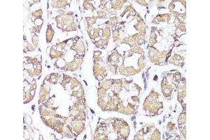 Immunohistochemistry of paraffin-embedded Human stomach using OPRK1 Polyclonal Antibody at dilution of 1:100 (40x lens). (OPRK1 anticorps)