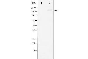 Western blot analysis of WNK1 expression in EGF treated 293 whole cell lysates,The lane on the left is treated with the antigen-specific peptide. (WNK1 anticorps  (N-Term))