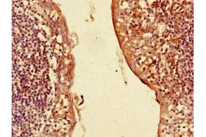 Immunohistochemistry of paraffin-embedded human tonsil tissue using ABIN7146133 at dilution of 1:100 (CXCL3 anticorps  (AA 35-107))
