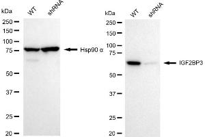 Western blotting analysis using IGF2BP3 antibody (ABIN7799052).