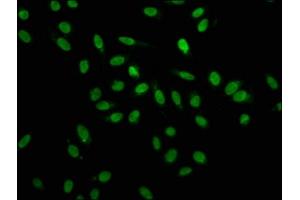 Immunofluorescence staining of Hela cells with ABIN7155098 at 1:100, counter-stained with DAPI.
