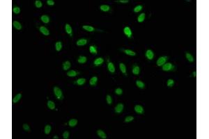 Immunofluorescence staining of Hela cells with ABIN7155098 at 1:100, counter-stained with DAPI. (HNRNPA1 anticorps  (AA 2-354))
